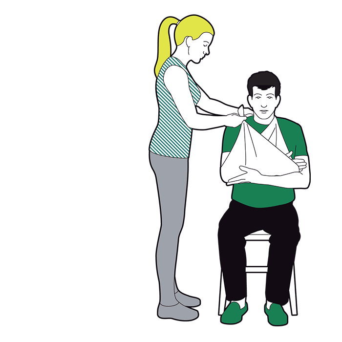 Arm sling - fold lower end up over the forearm to the neck, same side as injury