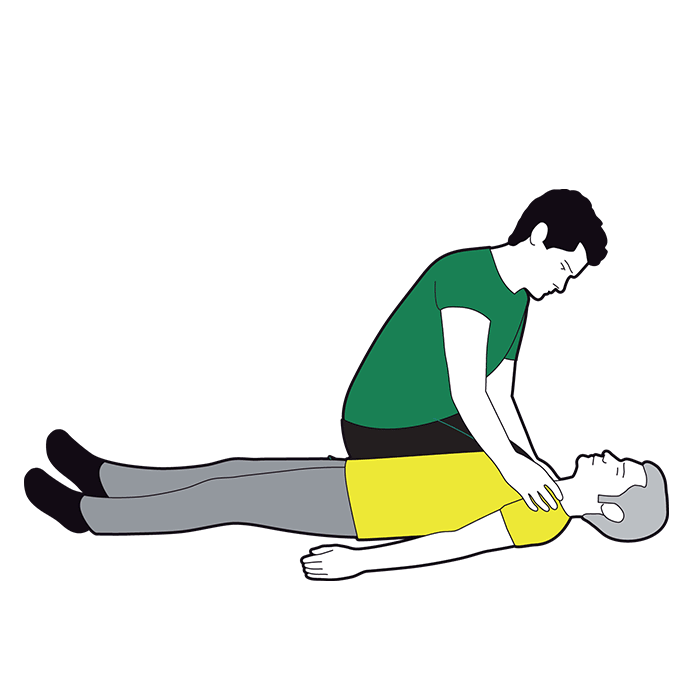 Primary survey - circulation - check for severe bleeding