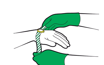 Adult minor burns and scalds - remove jewellery or clothing