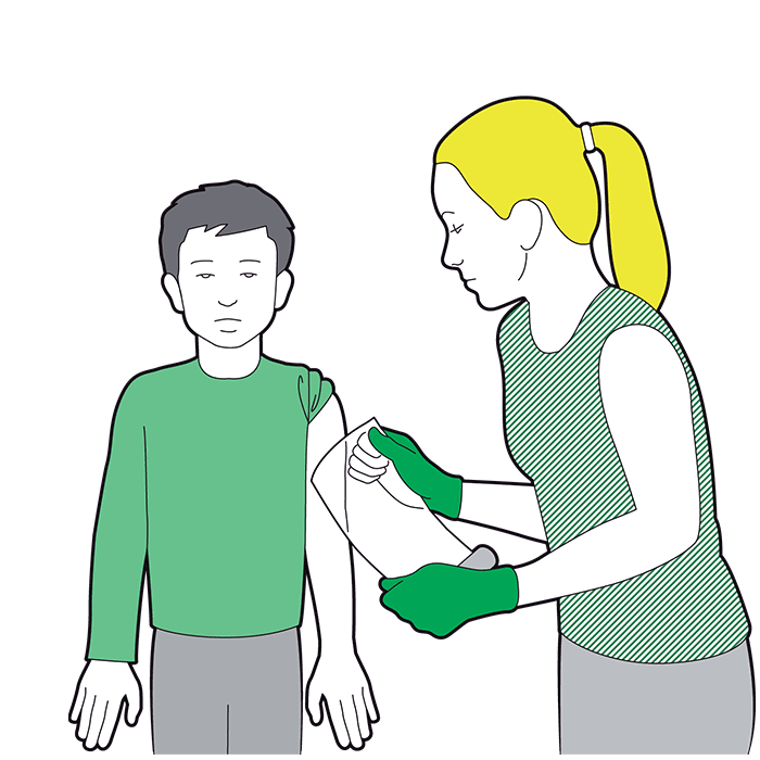 Burns and scalds - children - cover the area loosly with clingfilm