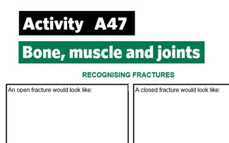 KS4-A47-Recognise fractures