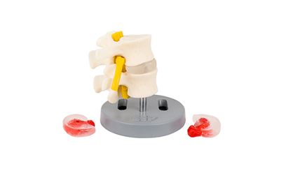 ESP Dissectible Lumbar Vertebrae Training Model